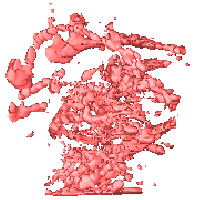 tumour vessel without tumour tissue