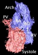 ToF systolic movie, GIF 343KB