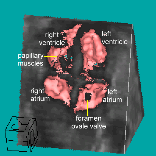 3D fetal heart, 286KB gif movie