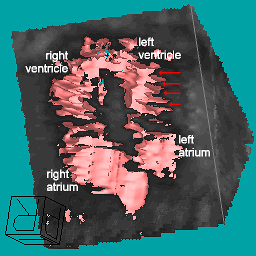 3D fetal heart, 311KB gif movie