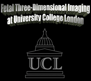 A visible fetus by 3D MRI