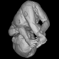 3D MRI fetus - 800KB gif movie. If difficult to download, try 250KB one below