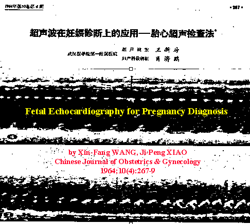 Fetal Echocardiography for Pregnancy Diagnosis