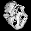 fetus (MRI)