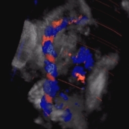 3D umbilical cord - avi movie 183KB