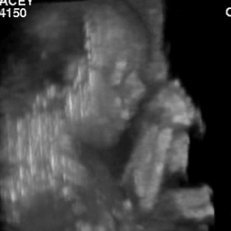 3d fetal face hands - avi movie 217KB