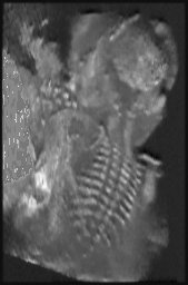 The Developing Fetal Skeleton (AVI movie 146KB)