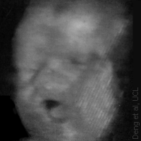 A Yawning Fetus (AVI movie 225KB)