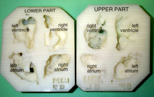 3D fetal heart model