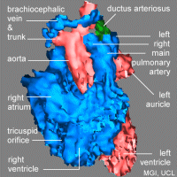 3D fetal heart, 784KB gif movie