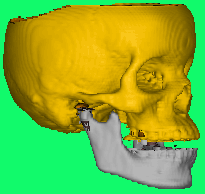 Skull