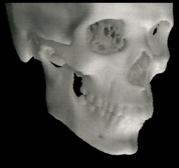 ABS model of normal skull
