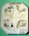 Fetal Heart