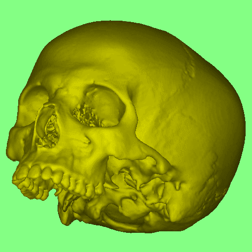 Skull