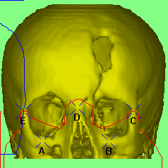 Markers on Image